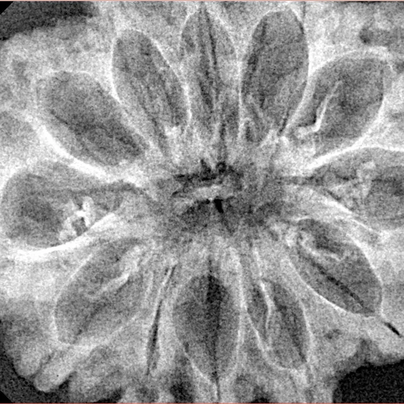 12 Mukhi Rudraksha 34.3mm 6.36gm - Xray