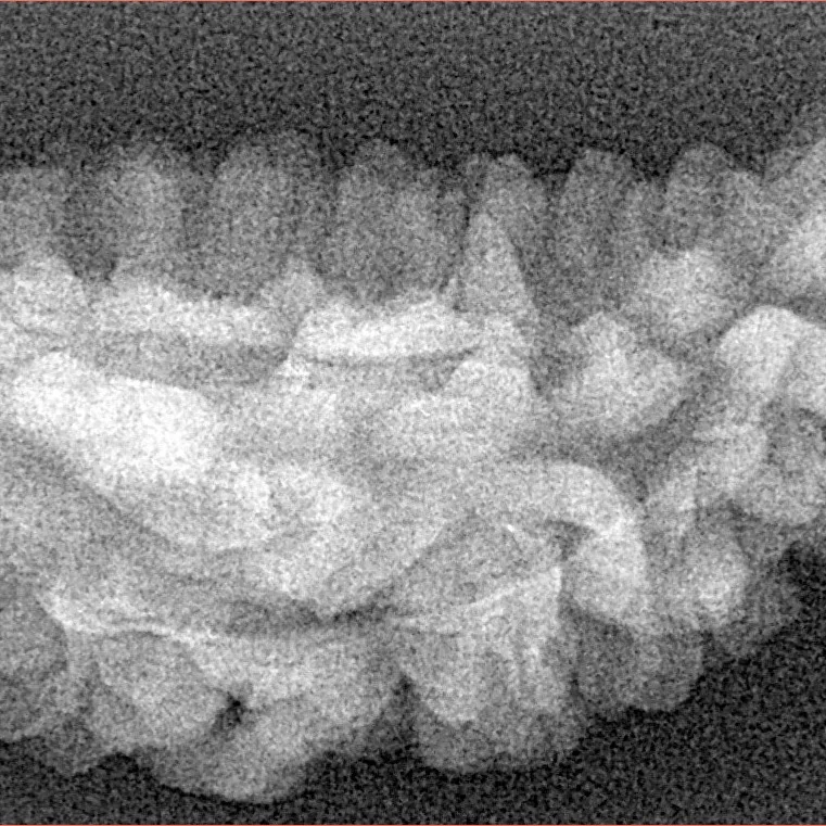 1 Mukhi Rudraksha 48.2mm 6.62gm - Xray
