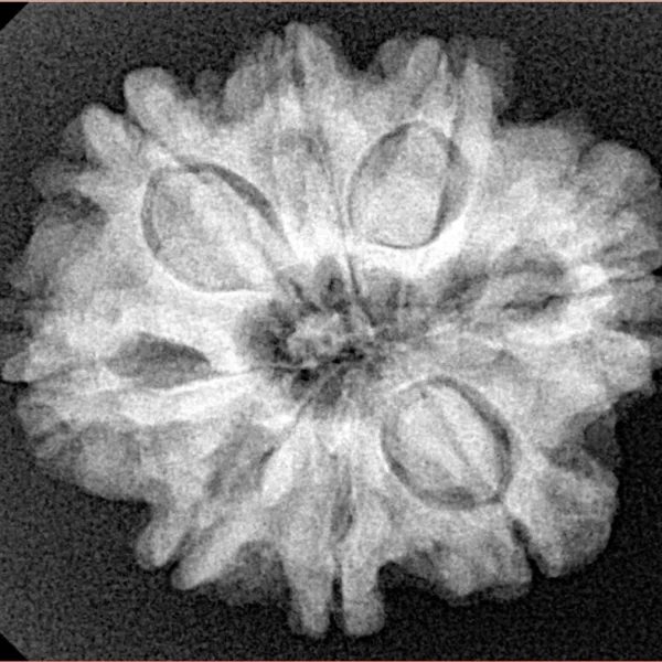 8 Mukhi Rudraksha 25.6mm 5gm - Xray