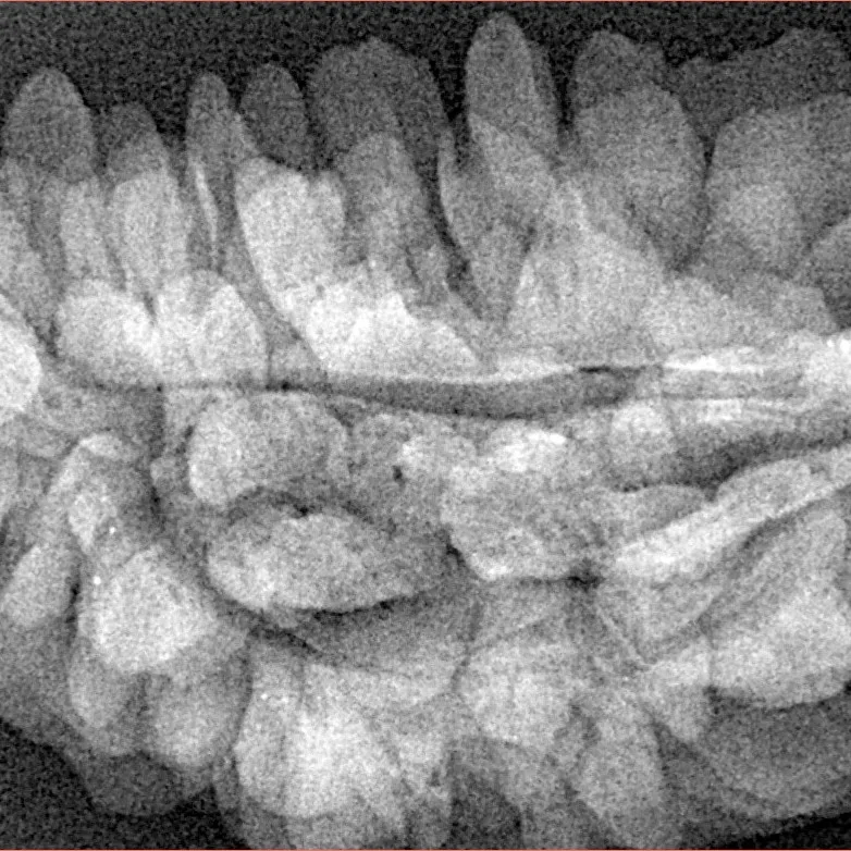 1 Mukhi Rudraksha 39.1mm 6.48gm - Xray