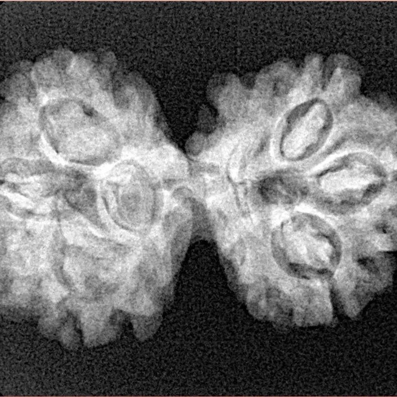 7 MK Gaurishankar 31mm 4gm - Xray