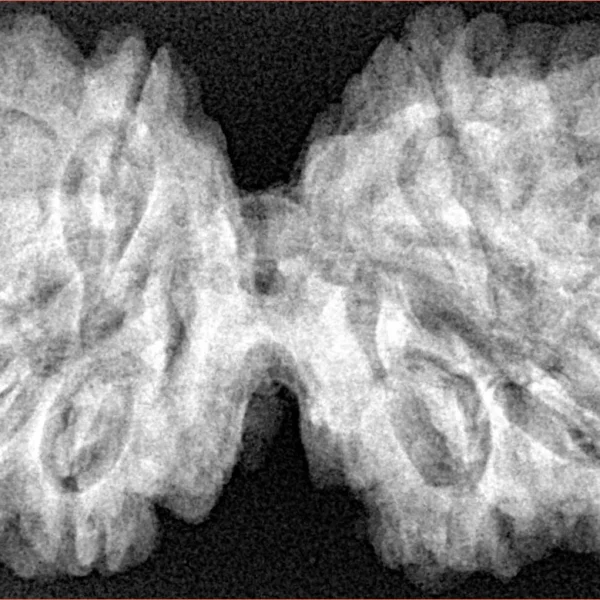 10 Mk Gaurishankar 40.6mm 8.6gm - Xray