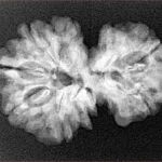 7 MK Gaurishankar 27.1mm 3.91gm - Xray