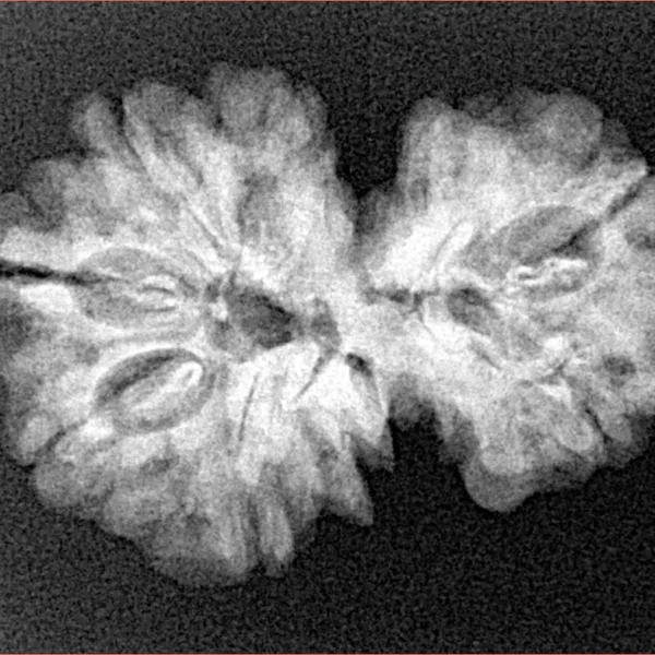 7 MK Gaurishankar 27.1mm 3.91gm - Xray