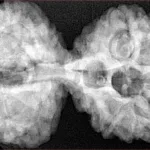 11 MK Gaurishankar 42.4mm 9.82gm - Xray