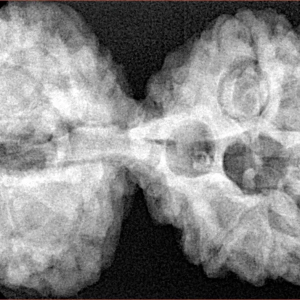 11 MK Gaurishankar 42.4mm 9.82gm - Xray