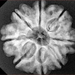 8 Mukhi Rudraksha 25.3mm 5.18gm - Xray