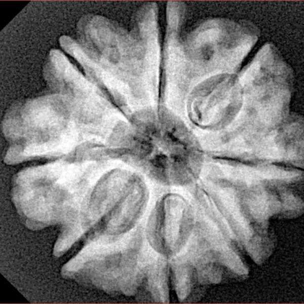 8 Mukhi Rudraksha 25.3mm 5.18gm - Xray
