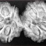 10 Mk Gaurishankar 39.8mm 8.32gm - Xray