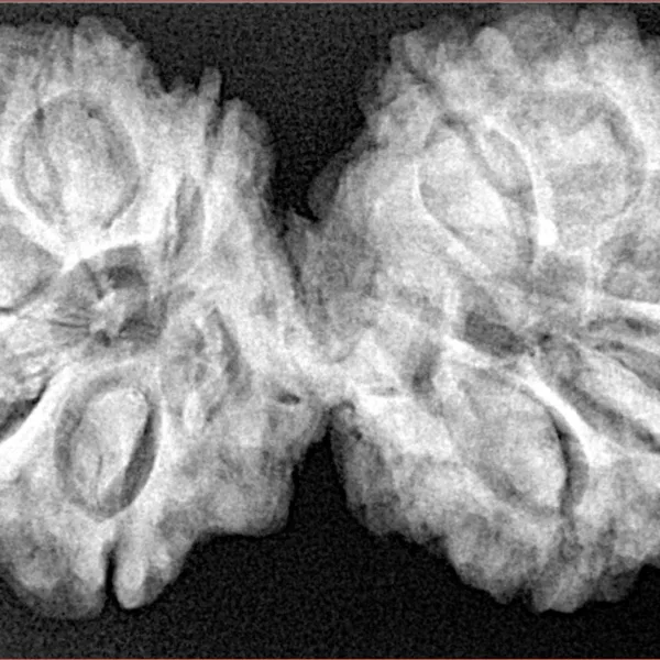 10 Mk Gaurishankar 39.8mm 8.32gm - Xray