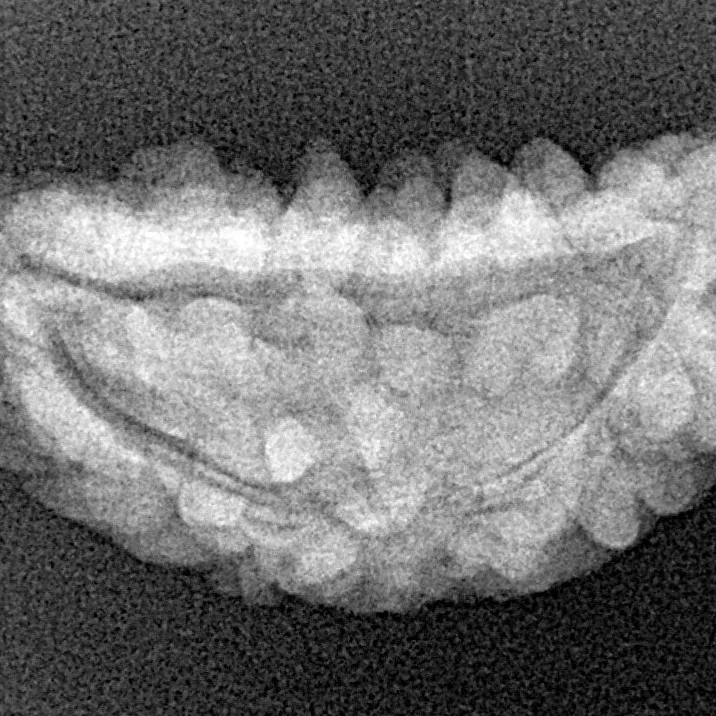 1 Mukhi Rudraksha 25.9mm 2.59gm - Xray