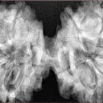 9 MK Gaurishankar 44.7mm 11.11gm - Xray