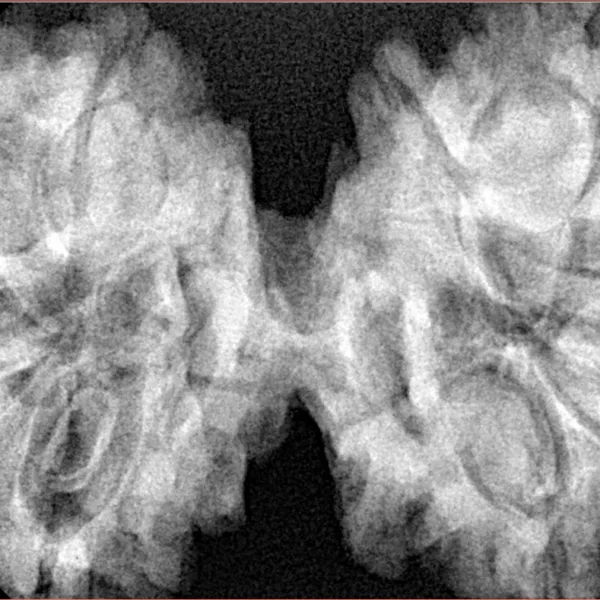 9 MK Gaurishankar 44.7mm 11.11gm - Xray