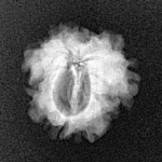 1 Mukhi Rudraksha 18.7mm 1.74gm - Xray