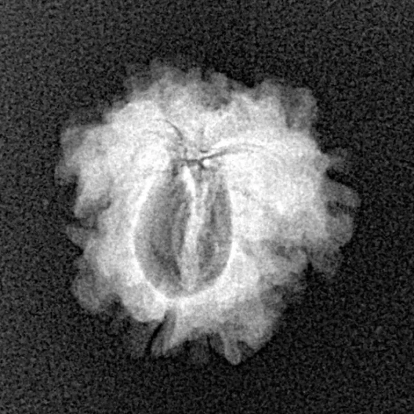 1 Mukhi Rudraksha 18.7mm 1.74gm - Xray