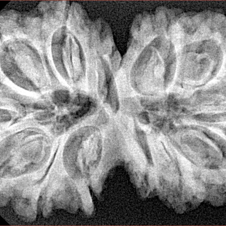 13 MK Gaurishankar 37.6mm 7.55gm - Xray