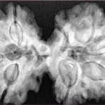9 MK Gaurishankar 41.1mm 9.62gm - Xray