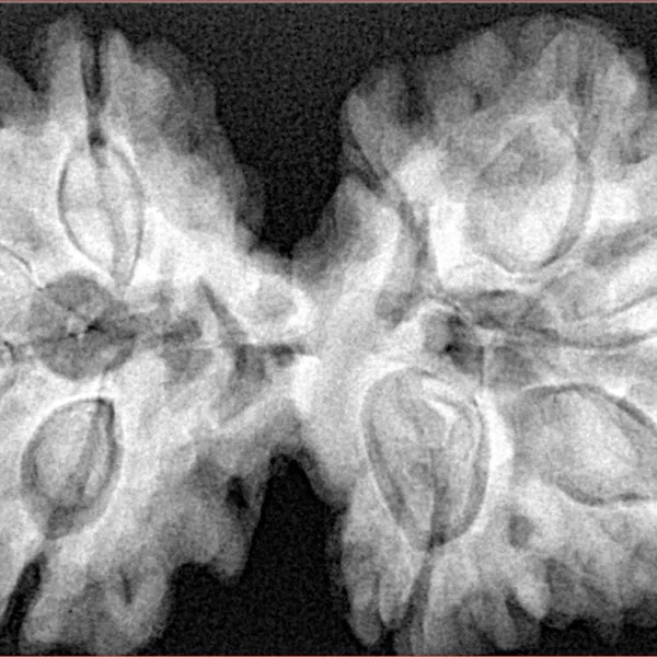 9 MK Gaurishankar 41.1mm 9.62gm - Xray
