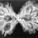 11 MK Gaurishankar 38.9mm 6.37gm - Xray