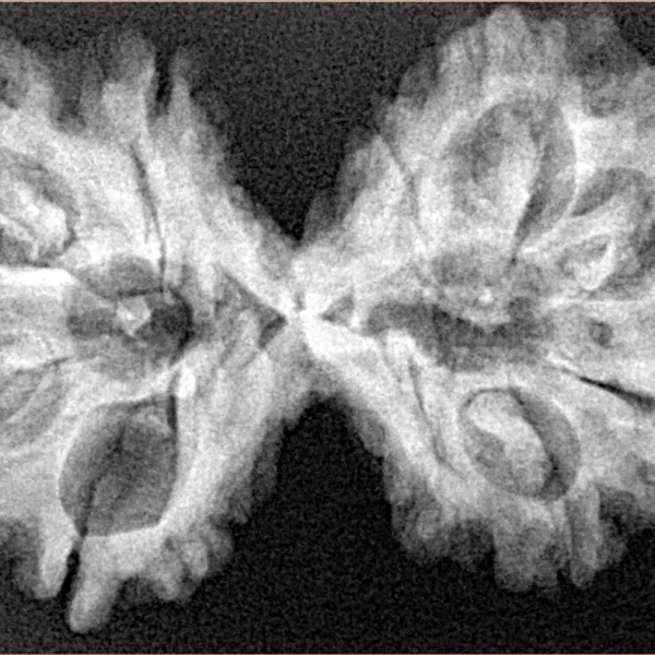 11 MK Gaurishankar 38.9mm 6.37gm - Xray