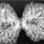 10 Mk Gaurishankar 40.5mm 9.38gm - Xray
