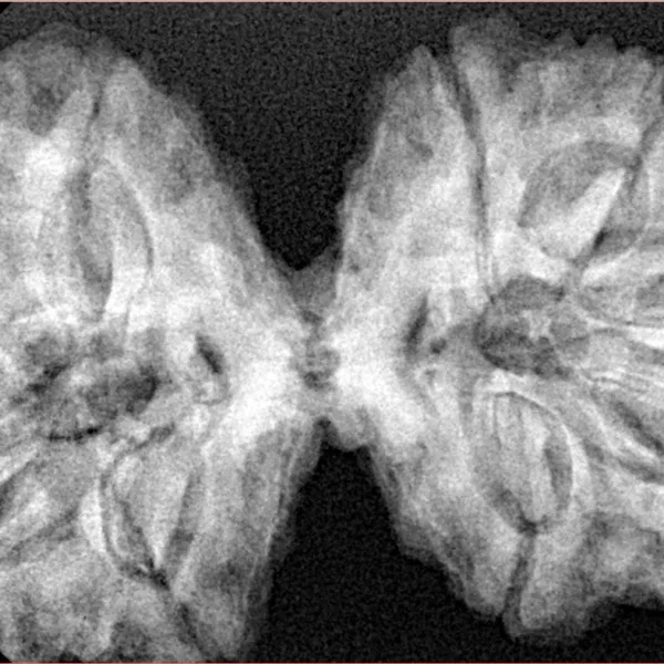 10 Mk Gaurishankar 40.5mm 9.38gm - Xray