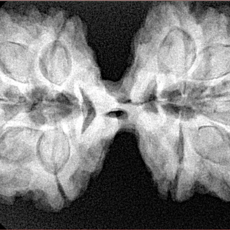 10 Mk Gaurishankar 36.7mm 7.88gm - Xray
