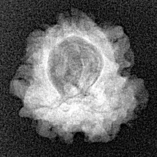 1 Mukhi Rudraksha 18.2mm 1.61gm - Xray