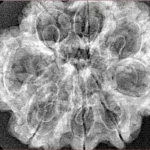 8 Mukhi Rudraksha 30.6mm 5.18gm - Xray