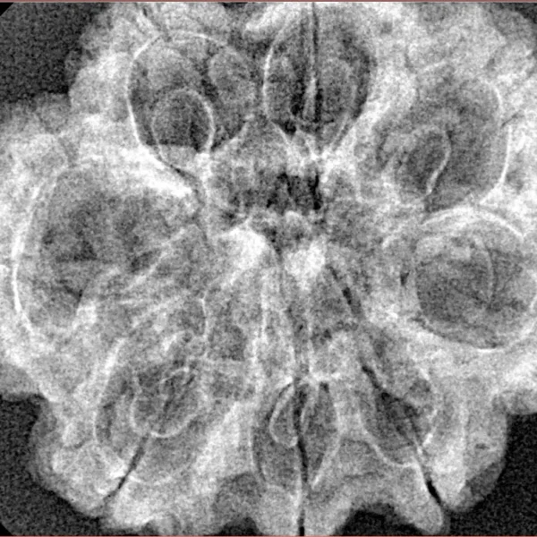 8 Mukhi Rudraksha 30.6mm 5.18gm - Xray