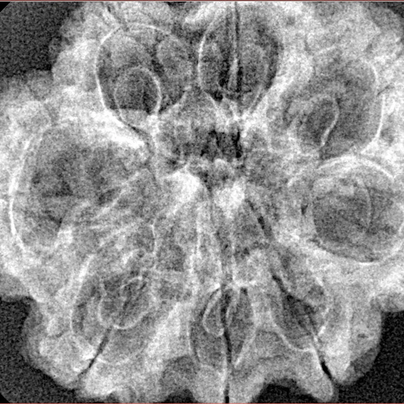 8 Mukhi Rudraksha 30.6mm 5.18gm - Xray