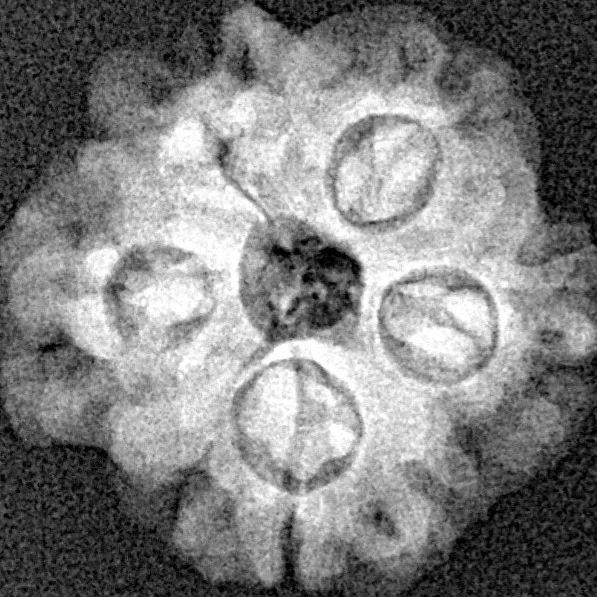 1MK(Underdeveloped) 19.6mm 2.67gm - Xray