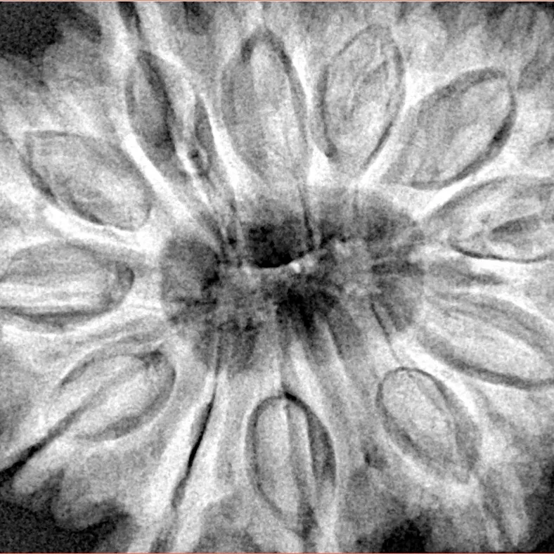 12 Mukhi Rudraksha 35.8mm 10.16gm - Xray