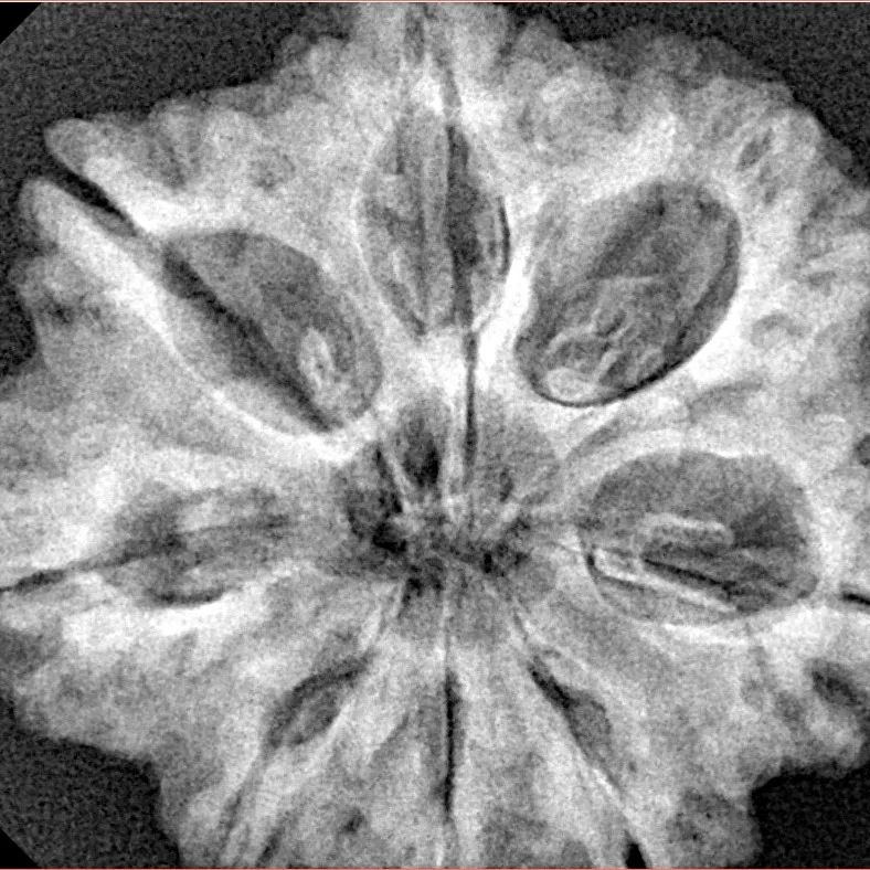 8 Mukhi Rudraksha 29.6mm 6.9gm - Xray