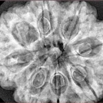 8 Mukhi Rudraksha 31.7mm 6.75gm - Xray