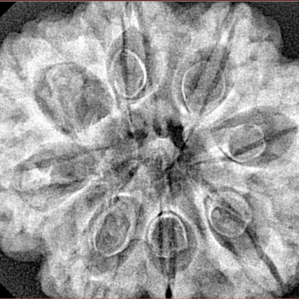 8 Mukhi Rudraksha 31.7mm 6.75gm - Xray