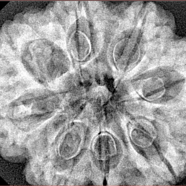 8 Mukhi Rudraksha 31.7mm 6.75gm - Xray
