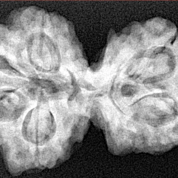 6 Mk Gaurishankar 32.6mm 6.64gm - Xray
