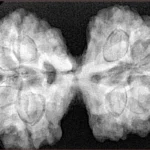 9 MK Gaurishankar 39.7mm 9.51gm - Xray