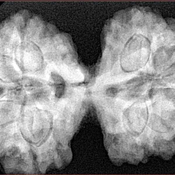 9 MK Gaurishankar 39.7mm 9.51gm - Xray