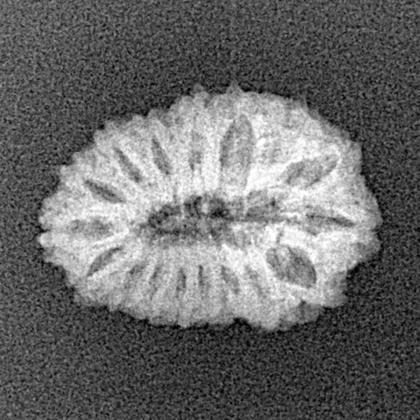 17 Mukhi Rudraksha 19mm 1.35gm - Xray