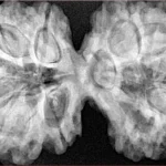 10 Mk Gaurishankar 40.6mm 9.16gm - Xray