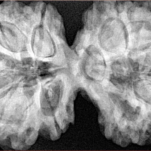 10 Mk Gaurishankar 40.6mm 9.16gm - Xray
