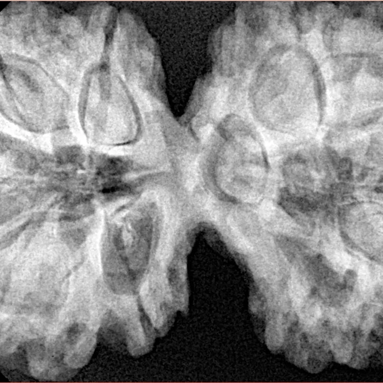 10 Mk Gaurishankar 40.6mm 9.16gm - Xray