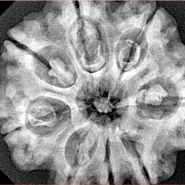 8 Mukhi Rudraksha 29.4mm 7.09gm - Xray
