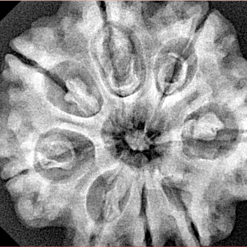 8 Mukhi Rudraksha 29.4mm 7.09gm - Xray