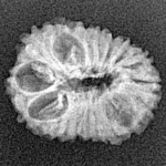 16 Mukhi Rudraksha 18.9mm 1.36gm - Xray