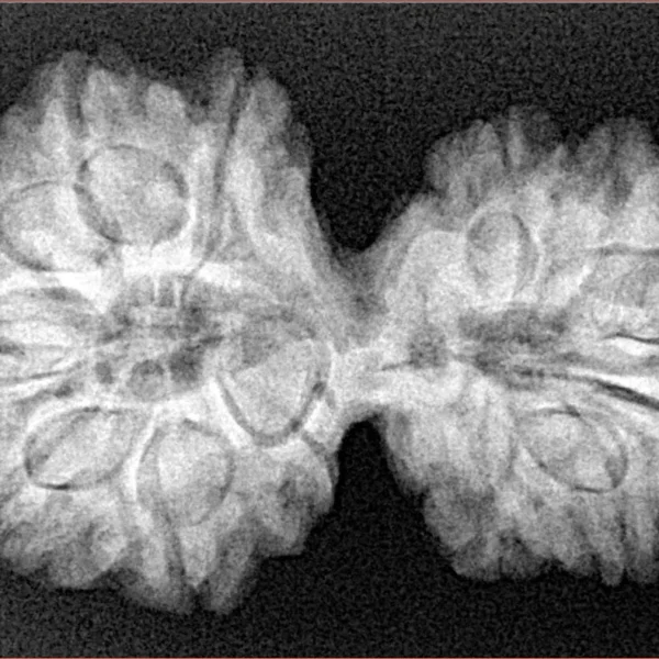 13 MK Gaurishankar 35.2mm 6.2gm - Xray