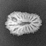 17 Mukhi Rudraksha 17.5mm 1.06gm - Xray