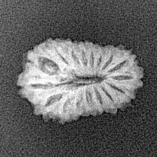 17 Mukhi Rudraksha 17.5mm 1.06gm - Xray